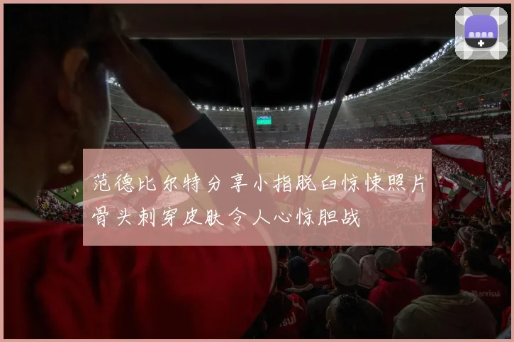 范德比尔特分享小指脱臼惊悚照片骨头刺穿皮肤令人心惊胆战